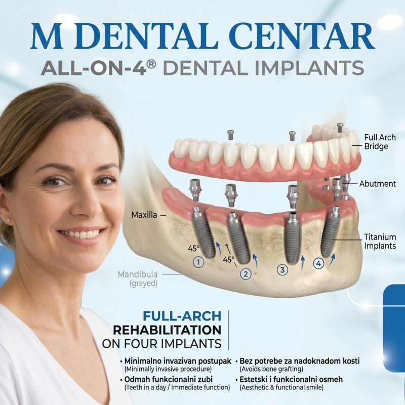 allon4mdental