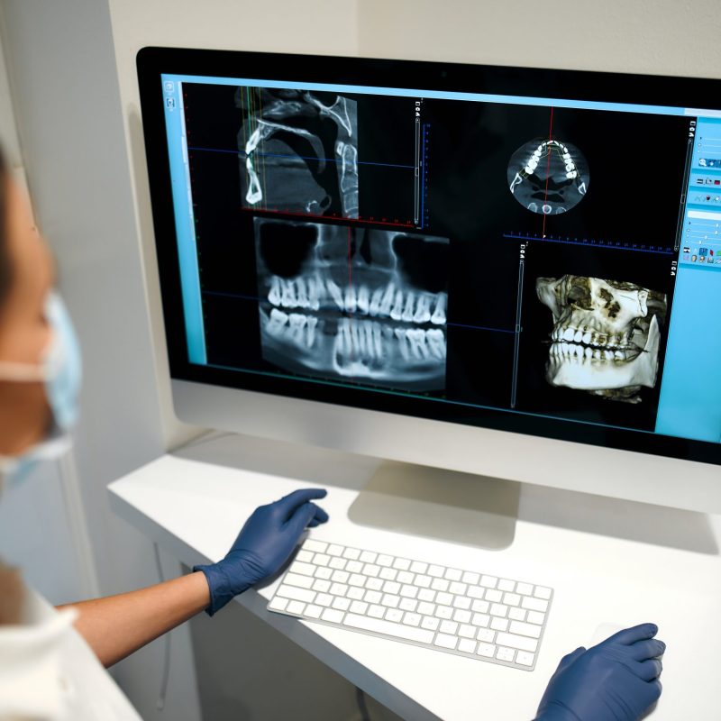 A young woman dentist in a medical mask examines an x-ray image on a computer in a dental office with modern equipment. Caries treatment. Dentistry and dental care.